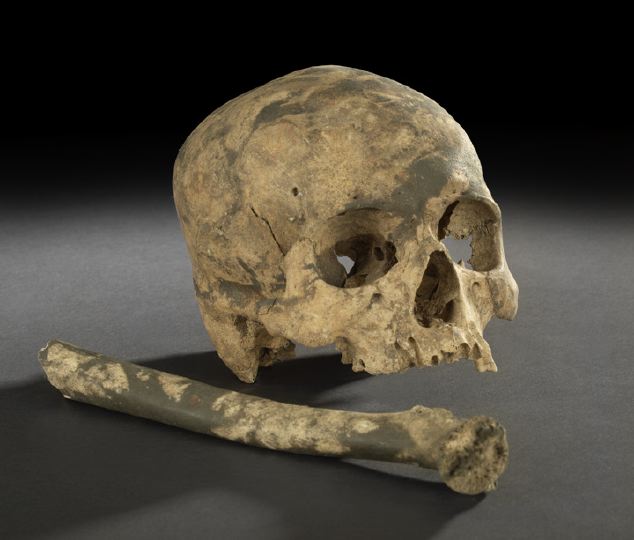 Charred Human Skull and Femur  2c4b3