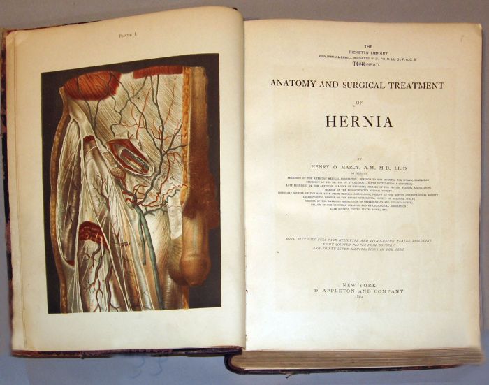 1 vol Marcy Henry O Anatomy 49e21