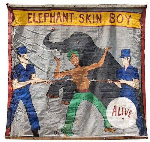 ELEPHANT-SKIN BOY. ALIVE.Elephant-Skin