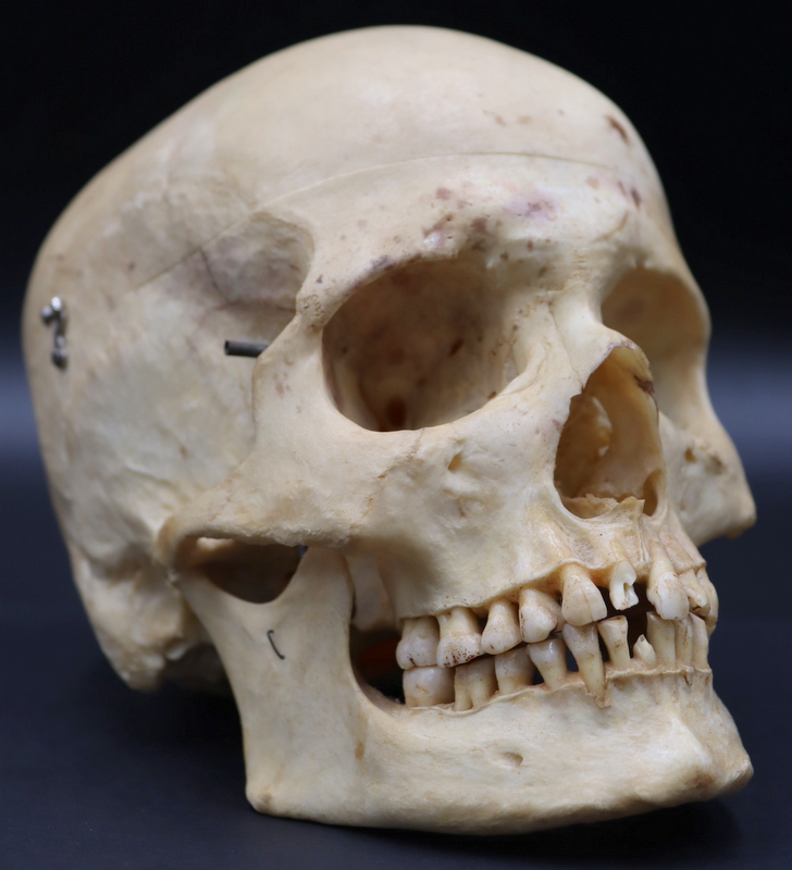 ANTIQUE MEDICAL HUMAN SKULL From 3b7acd