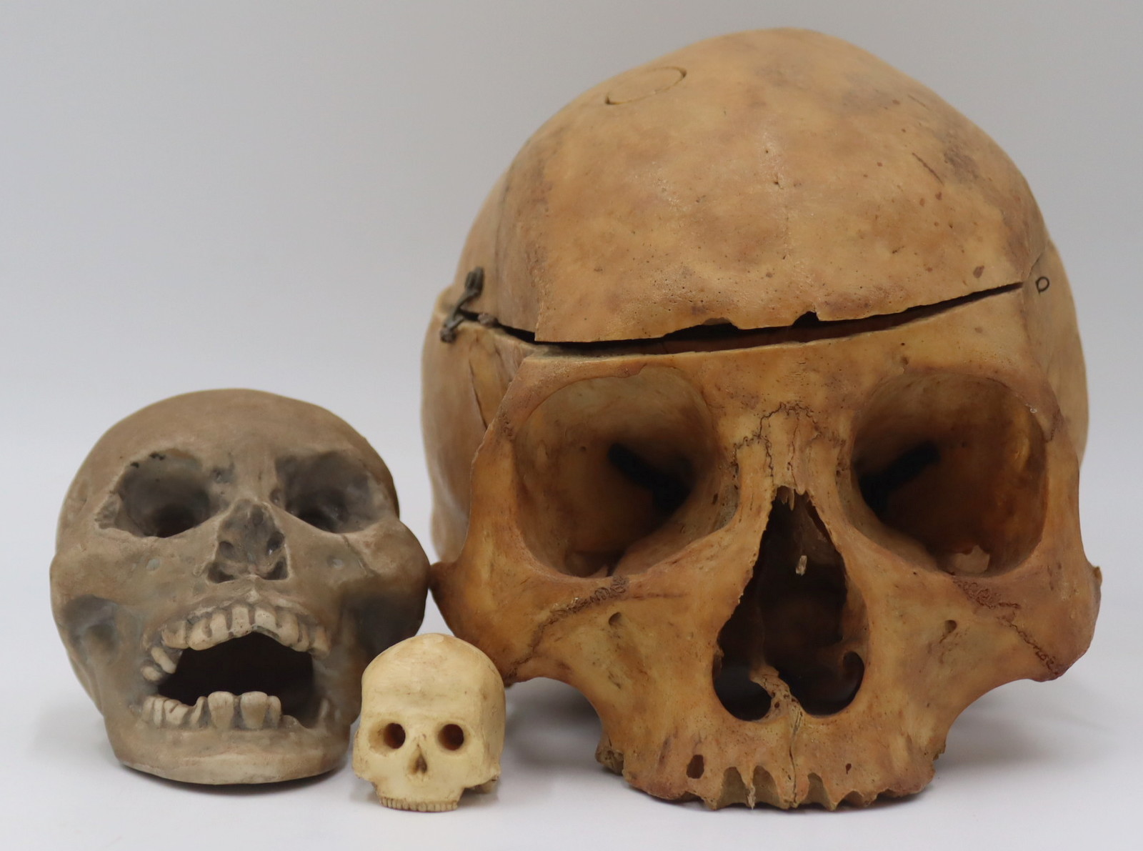 ANTIQUE MEDICAL HUMAN SKULL WITH