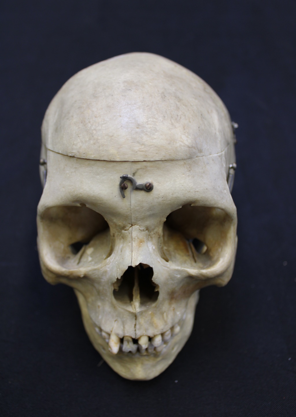 ANTIQUE MEDICAL SKULL WITH LATERAL 3bc1fe