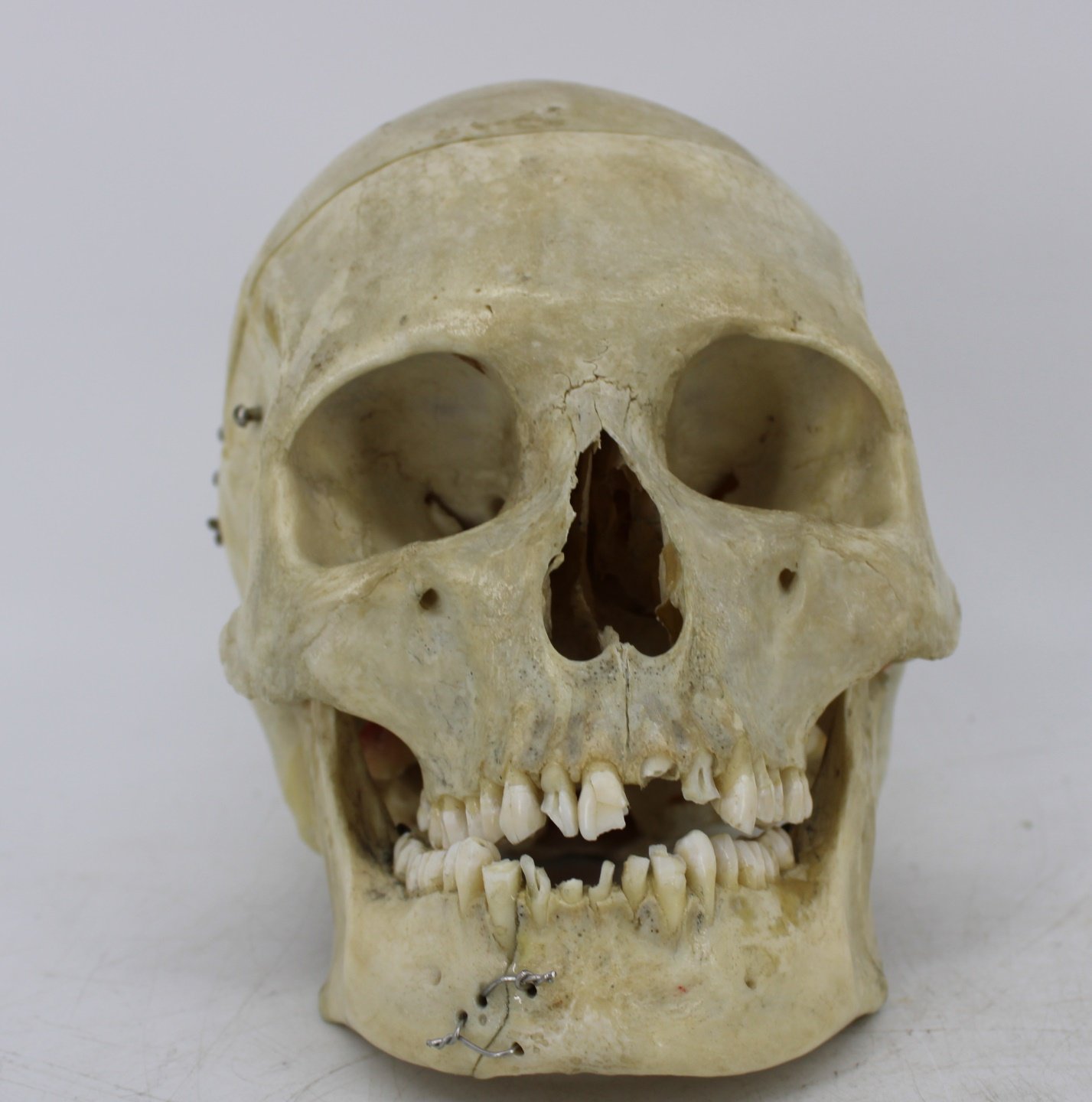 ANTIQUE MEDICAL HUMAN SKULL From 3bc40f