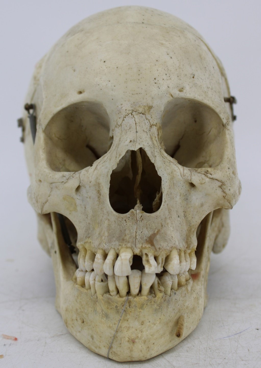 ANTIQUE MEDICAL HUMAN SKULL With 3bc410