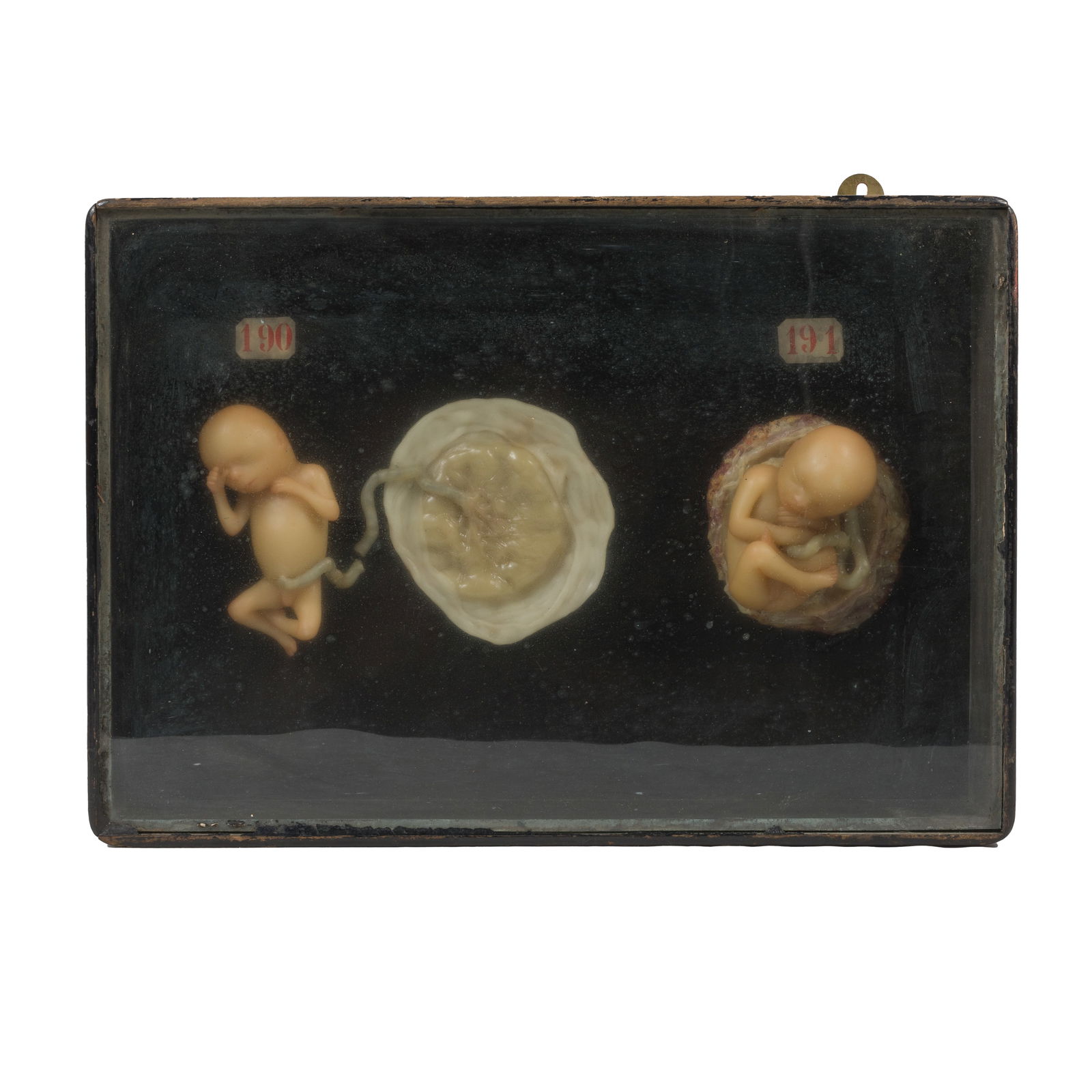 19TH CENTURY WAX MODELS,