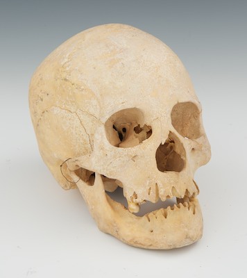 A Disarticulated Human Skull A