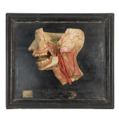 ANATOMICAL WAX HEAD MODEL<br>A