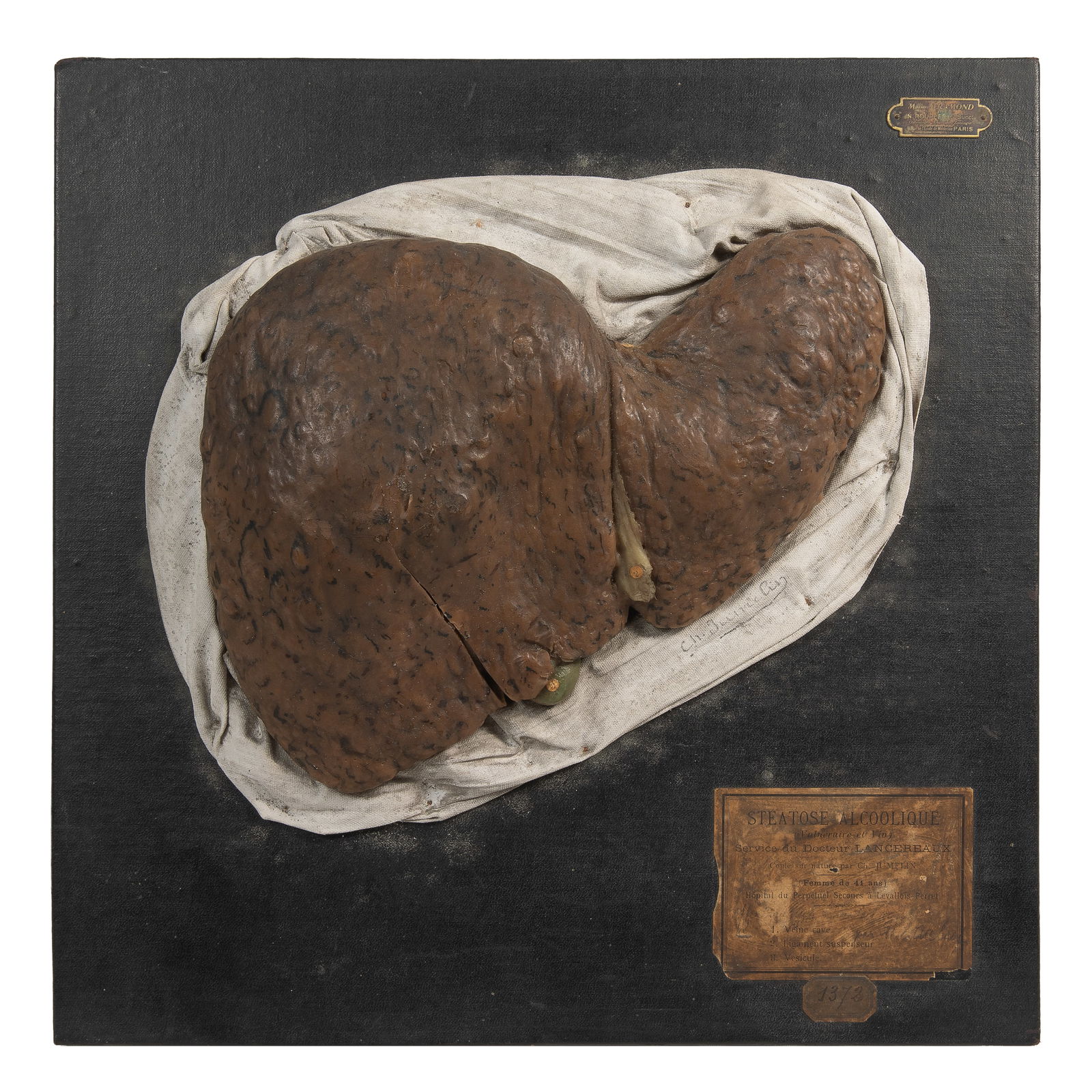 ANATOMICAL WAX LIVER, MAISON