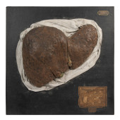ANATOMICAL WAX LIVER, MAISON T