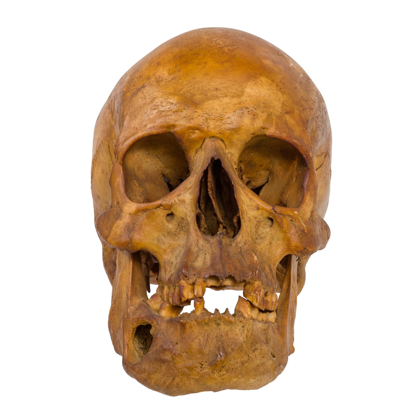 ANTIQUE HUMAN SKULLAntique Human