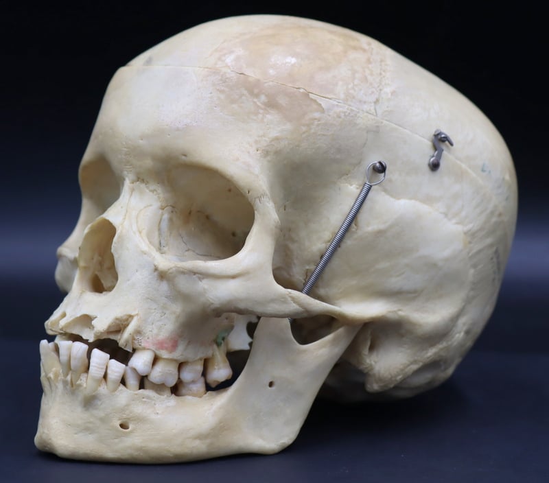 ANTIQUE MEDICAL HUMAN SKULL