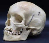 ANTIQUE MEDICAL HUMAN SKULL CL