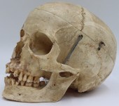 ANTIQUE MEDICAL SCHOOL HUMAN S