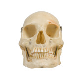 CLAY-ADAMS MEDICAL SKULL<br>Cl
