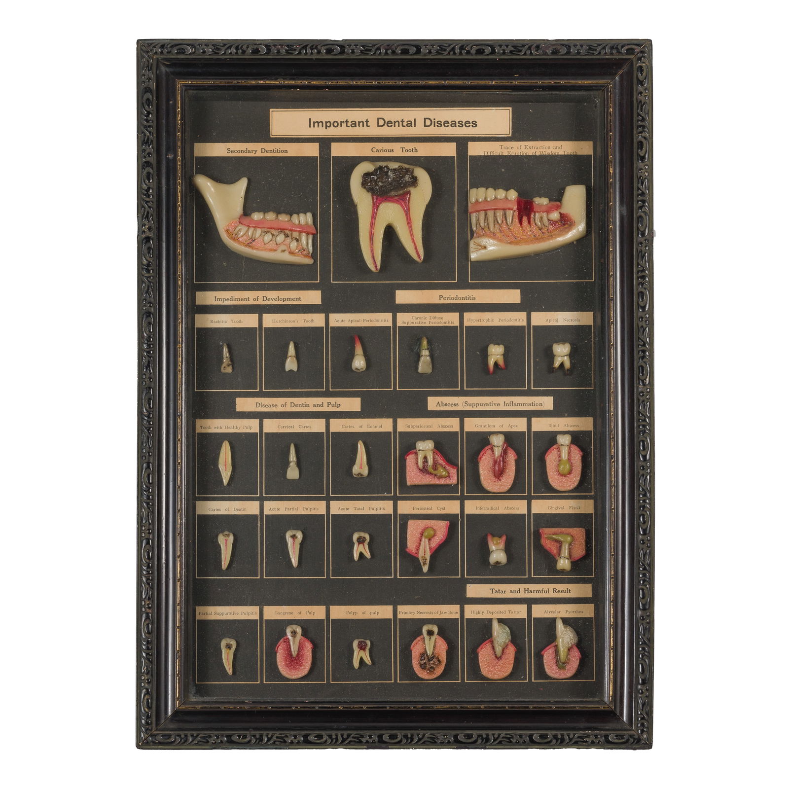 DISPLAY BOX WITH DENTAL WAX