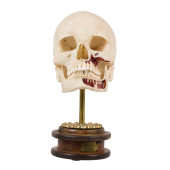 ENDENTULOUS HUMAN SKULL<br>End