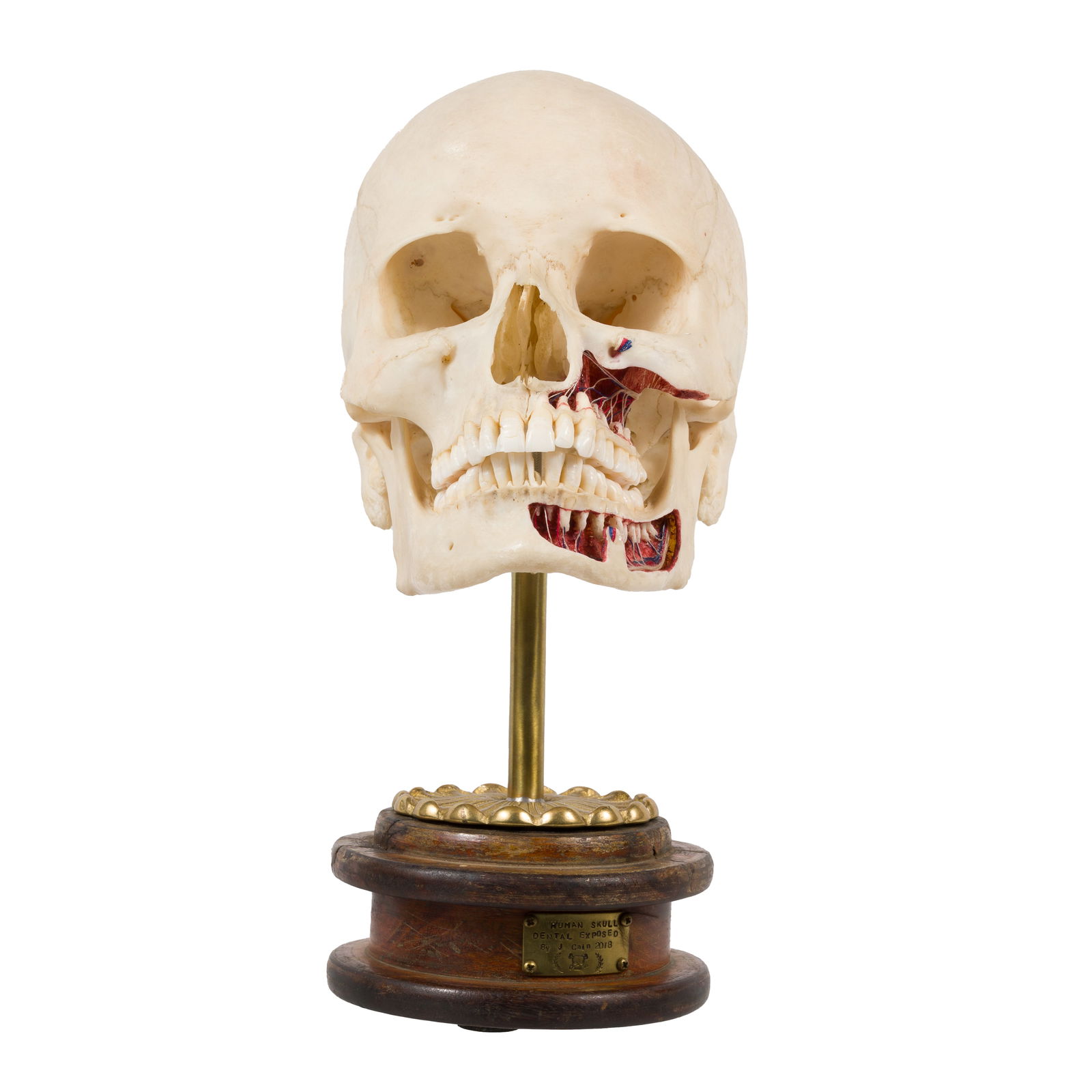 ENDENTULOUS HUMAN