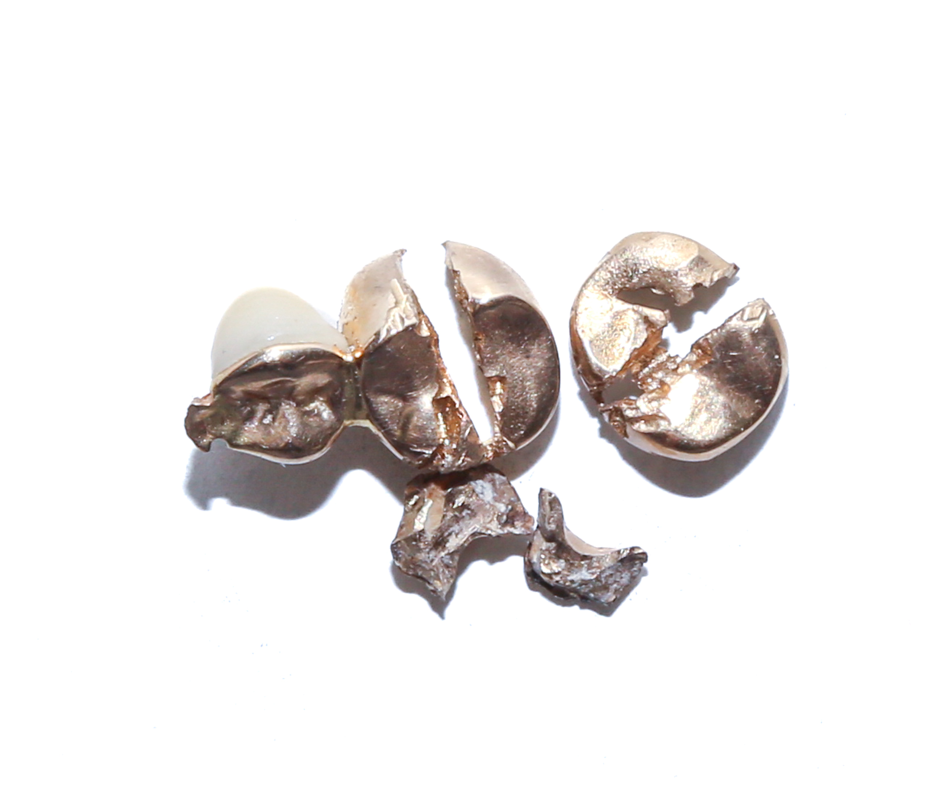 GOLD TOOTH SCRAPS Two pieces of 18K