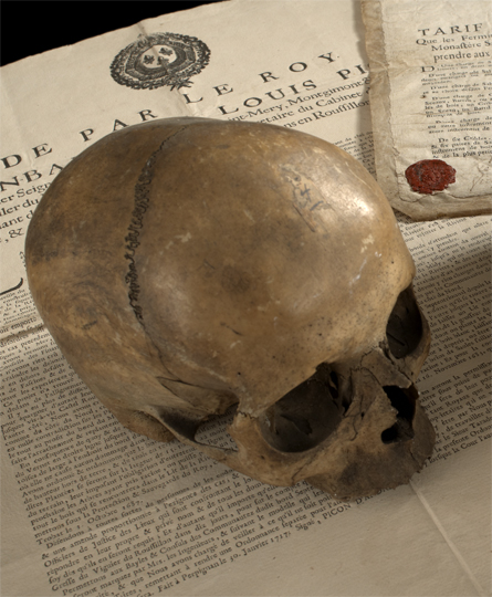 Human Skull,  of unknown origin,