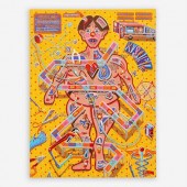 IAN YOUNG "OPERATING TABLE" (2