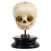 INFANT HUMAN SKULL<br>Infant H