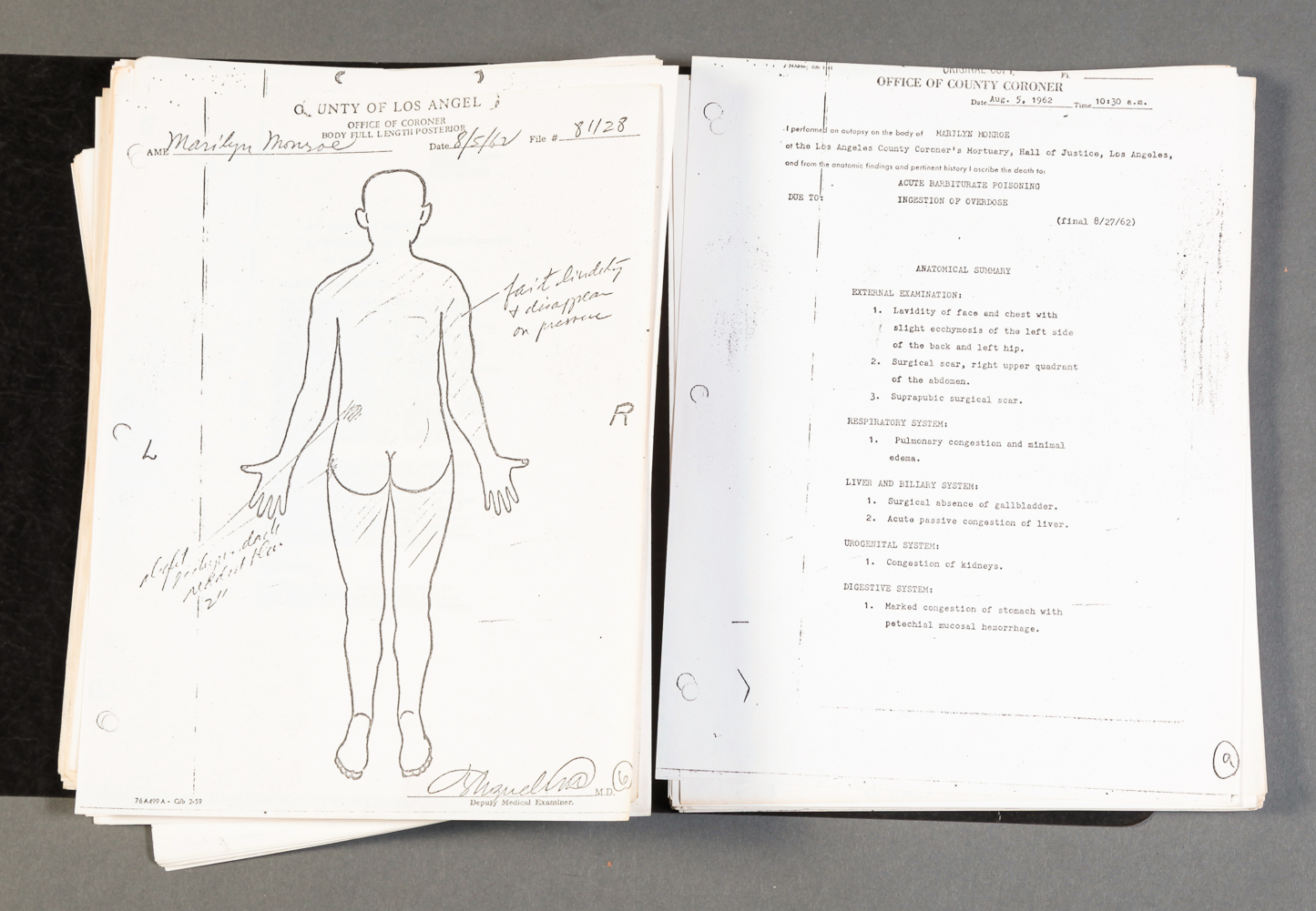 MARILYN MONROE AUTOPSY REPORT COPY.