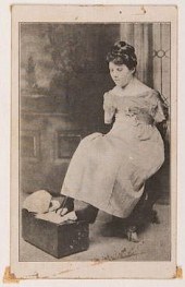 MISS IRENE WALDRON. ARMLESS WO