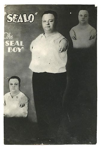 "SEALO" THE SEAL BOY SIDESHOW