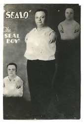 "SEALO" THE SEAL BOY SIDESHOW