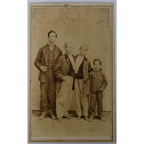 Siamese Twins Chang & Eng Bunker