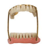 SPRUNG DENTURES IN GOLD & PORC