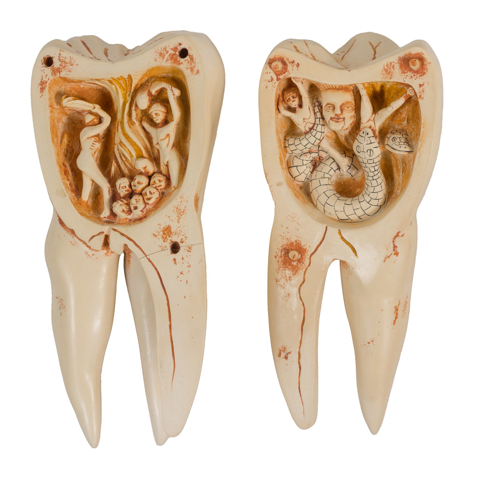 TOOTH MODEL, "THE TOOTH WORM AS