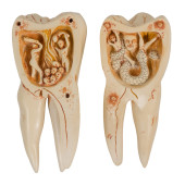 TOOTH MODEL, "THE TOOTH WORM A