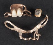 Two gold dental accessories; t