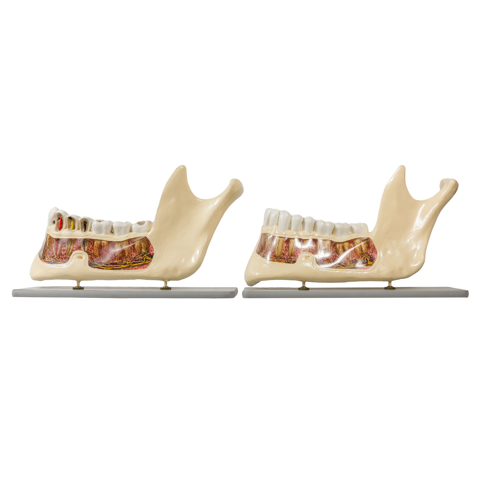 TWO LARGE LOWER JAW & TEETH