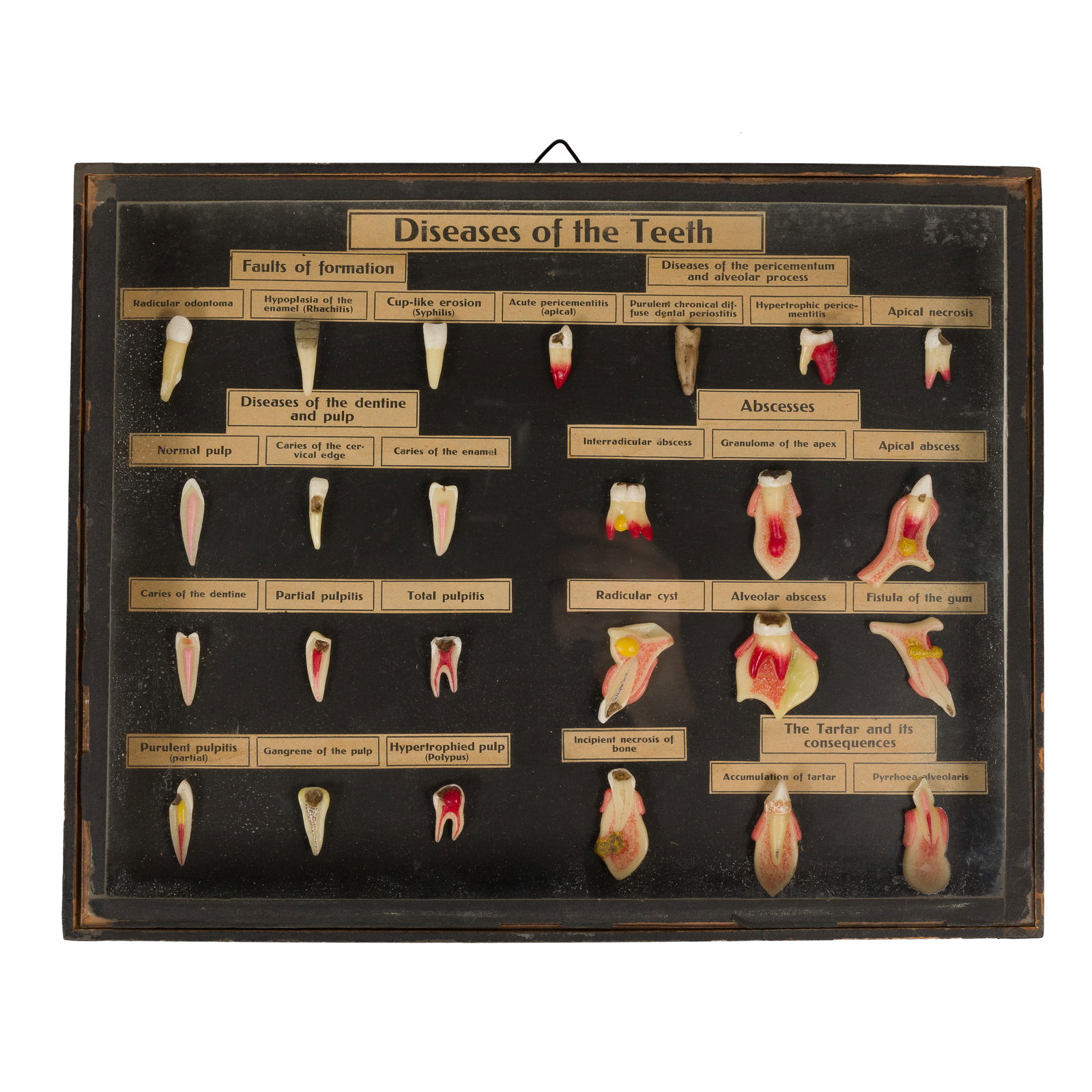 WAX ANATOMIC MODEL, DISEASES OF THE