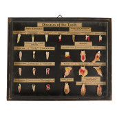 WAX ANATOMIC MODEL, DISEASES O