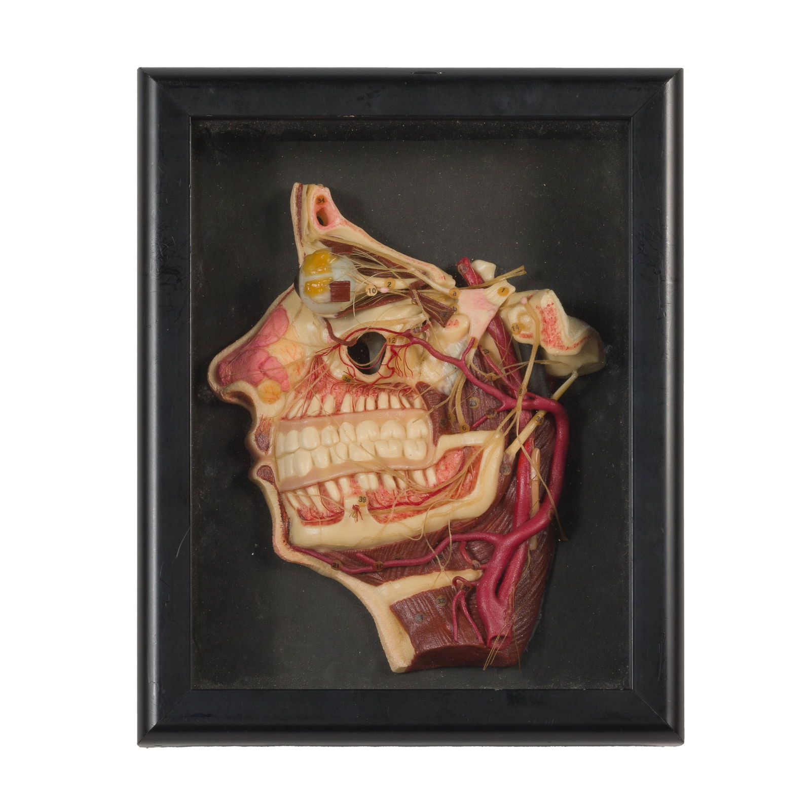 WAX DISSECTED HEAD MODELWax