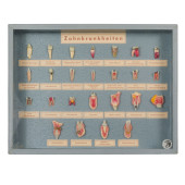 WAX TOOTH MODEL MUSEUM DISPLAY