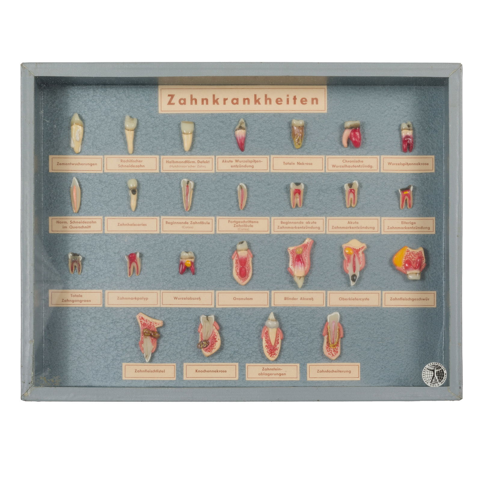 WAX TOOTH MODEL MUSEUM DISPLAYWax